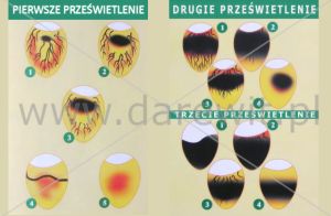 co widać w prześwietlarce jaj